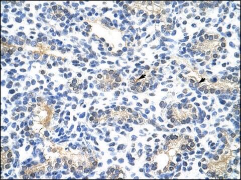 Anti-BLZF1 antibody produced in rabbit IgG fraction of antiserum