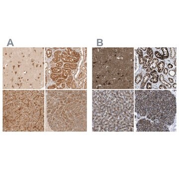 Anti-TMEM192 antibody produced in rabbit Prestige Antibodies&#174; Powered by Atlas Antibodies, affinity isolated antibody, buffered aqueous glycerol solution