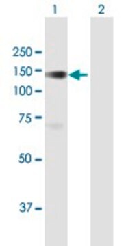 Anti-PLK4 antibody produced in mouse purified immunoglobulin, buffered aqueous solution