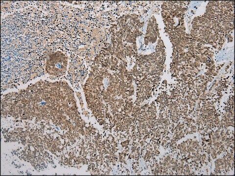 Anti-DCAF7 affinity isolated antibody