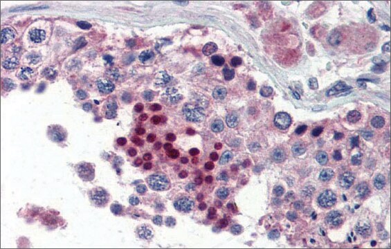 Anti-NR0B1 antibody produced in rabbit affinity isolated antibody