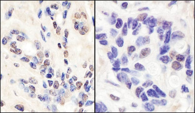 Rabbit anti-BRCA1 Antibody, Affinity Purified Powered by Bethyl Laboratories, Inc.