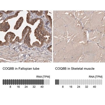 Anti-COQ8B antibody produced in rabbit Prestige Antibodies&#174; Powered by Atlas Antibodies, affinity isolated antibody, buffered aqueous glycerol solution, ab3