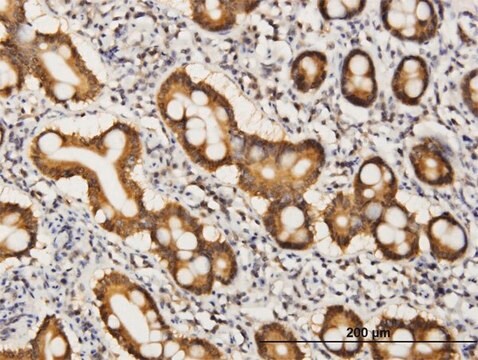 Monoclonal Anti-COASY, (C-terminal) antibody produced in mouse clone 2A12, purified immunoglobulin, buffered aqueous solution