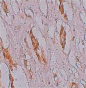 Anti-ZIP-1 Antibody from rabbit, purified by affinity chromatography