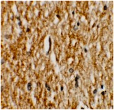 Anti-PHOX2A Antibody from rabbit, purified by affinity chromatography