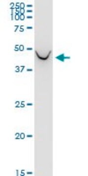 Monoclonal Anti-BCAT1 antibody produced in mouse clone 1F8, purified immunoglobulin, buffered aqueous solution