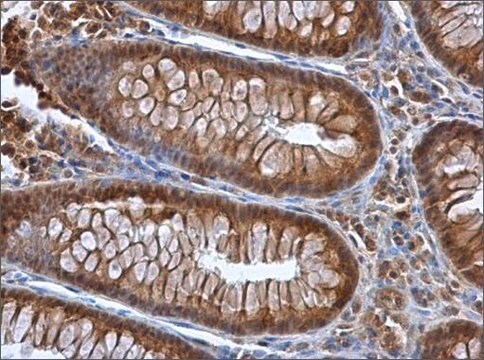 Anti-SEPP1 antibody produced in rabbit affinity isolated antibody, buffered aqueous solution