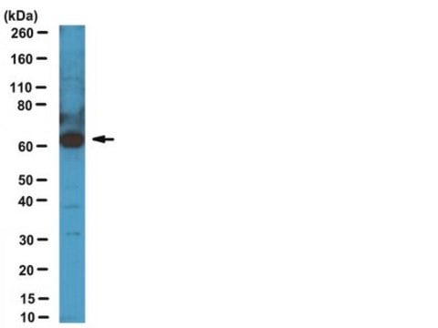 Anti-CDT1 Antibody serum, from rabbit