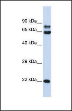 Anti-PPP2R1A, (N-terminal) antibody produced in rabbit affinity isolated antibody