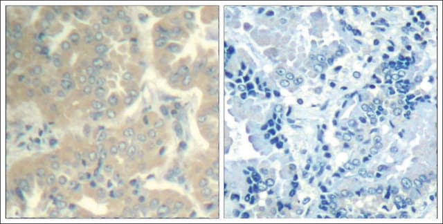 Anti-PTK2 (Ab-576/577) antibody produced in rabbit affinity isolated antibody