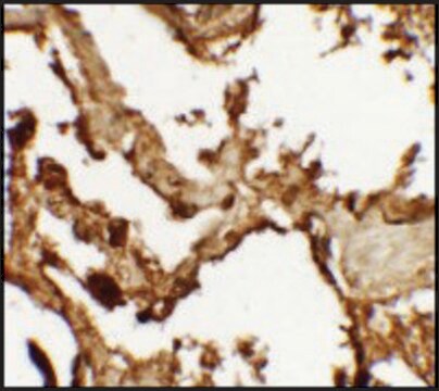 Anti-VKORC1 antibody produced in rabbit affinity isolated antibody