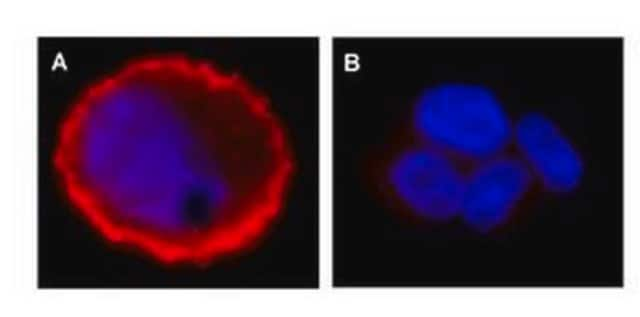 Anti-phospho-erbB-2/HER-2 (Tyr1248) Antibody Upstate&#174;, from rabbit