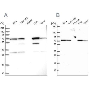 Anti-SDHA antibody produced in rabbit Prestige Antibodies&#174; Powered by Atlas Antibodies, affinity isolated antibody, buffered aqueous glycerol solution