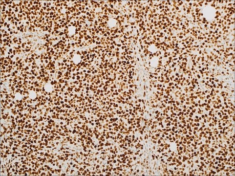 FOXP1 (EP137) Rabbit Monoclonal Primary Antibody