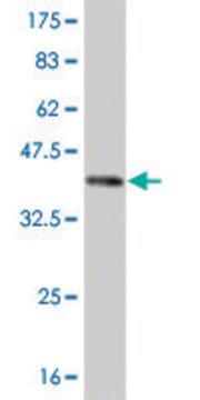 Monoclonal Anti-ROR2 antibody produced in mouse clone 4E1, purified immunoglobulin, buffered aqueous solution