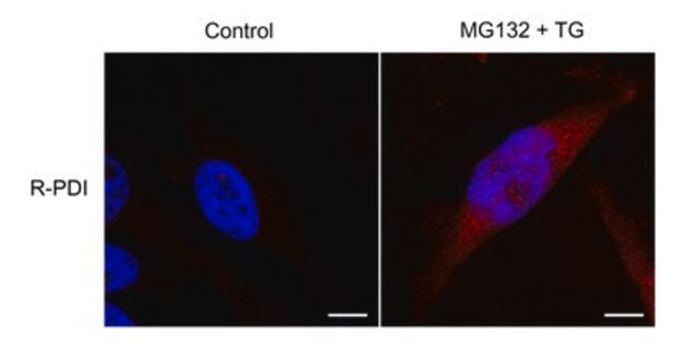 Anti-PDI Antibody, arginylated (Nt-Asp18) from rabbit, purified by affinity chromatography