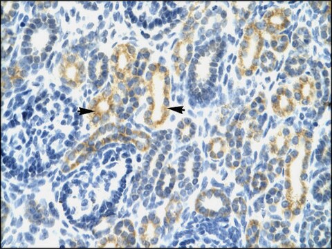 Anti-IRF8 antibody produced in rabbit affinity isolated antibody