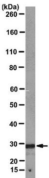 Anti-Chloride intracellular channel protein (CLIC1) Antibody, clone CPTC-CLIC1-1 clone CPTC-CLIC1, from mouse