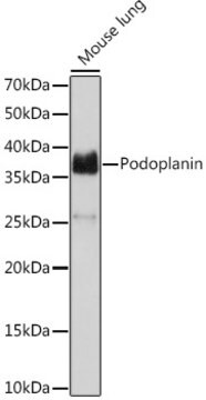 Anti-Podoplanin Antibody, clone 8I3I5, Rabbit Monoclonal