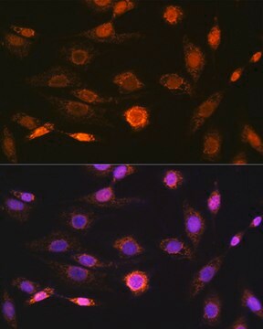 Anti-CAMKIV Antibody, clone 1G4P4, Rabbit Monoclonal