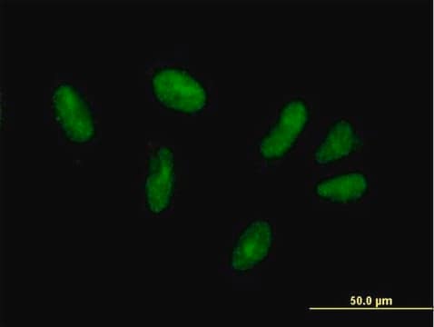 Anti-ZFP28 antibody produced in mouse purified immunoglobulin, buffered aqueous solution