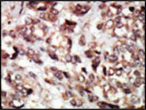 Anti-HIPK3 (center) antibody produced in rabbit IgG fraction of antiserum, buffered aqueous solution