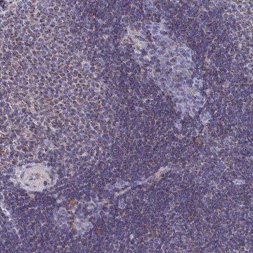 Anti-CCRL2 antibody produced in rabbit Prestige Antibodies&#174; Powered by Atlas Antibodies, affinity isolated antibody, buffered aqueous glycerol solution