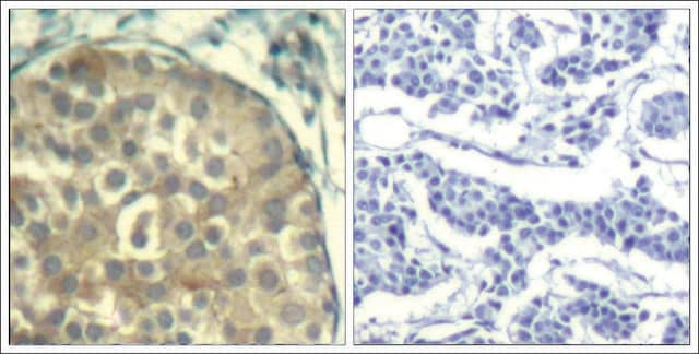 Anti-phospho-CFL1/CFL2 (pTyr88) antibody produced in rabbit affinity isolated antibody