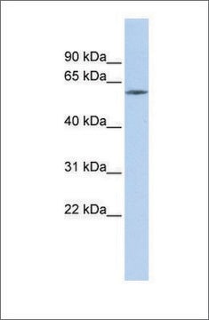 Anti-ZNF205 antibody produced in rabbit affinity isolated antibody