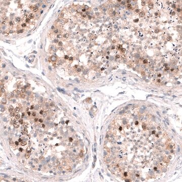 Anti-SHOC2 antibody produced in rabbit Prestige Antibodies&#174; Powered by Atlas Antibodies, affinity isolated antibody, buffered aqueous glycerol solution