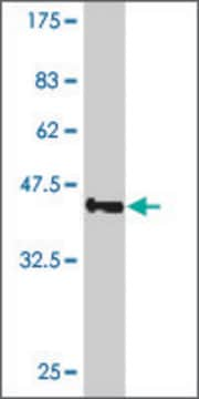 ANTI-SMO antibody produced in mouse clone 4E5, purified immunoglobulin, buffered aqueous solution