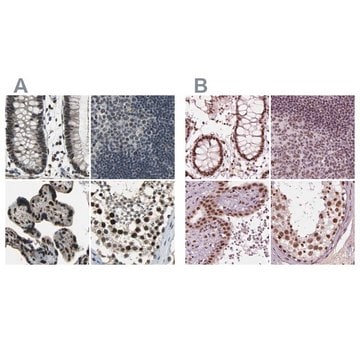 Anti-ELF2 antibody produced in rabbit Prestige Antibodies&#174; Powered by Atlas Antibodies, affinity isolated antibody, buffered aqueous glycerol solution