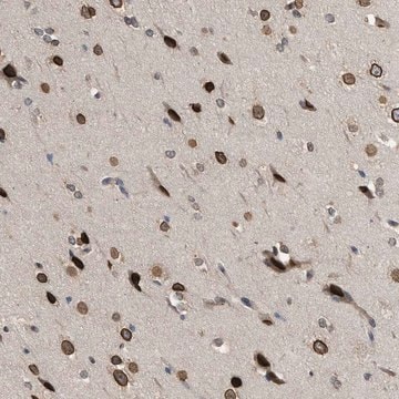 Anti-DNAJC1 antibody produced in rabbit Prestige Antibodies&#174; Powered by Atlas Antibodies, affinity isolated antibody, buffered aqueous glycerol solution