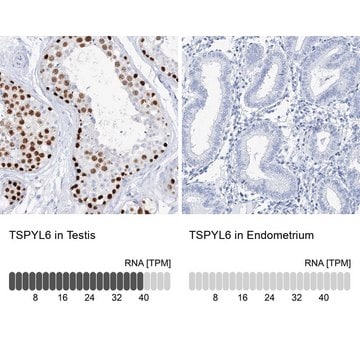 Anti-TSPYL6 antibody produced in rabbit Prestige Antibodies&#174; Powered by Atlas Antibodies, affinity isolated antibody, buffered aqueous glycerol solution