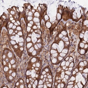 Anti-ABHD1 antibody produced in rabbit Prestige Antibodies&#174; Powered by Atlas Antibodies, affinity isolated antibody, buffered aqueous glycerol solution