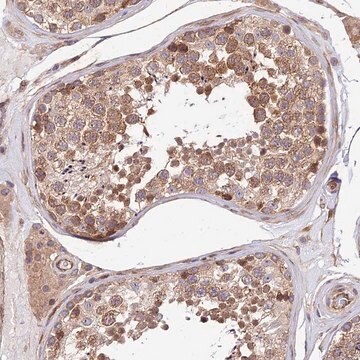 Anti-SMG6 antibody produced in rabbit Prestige Antibodies&#174; Powered by Atlas Antibodies, affinity isolated antibody, buffered aqueous glycerol solution