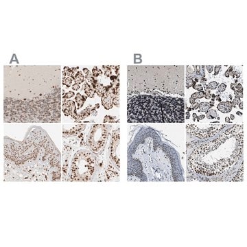 Anti-ZC3HC1 antibody produced in rabbit Prestige Antibodies&#174; Powered by Atlas Antibodies, affinity isolated antibody, buffered aqueous glycerol solution