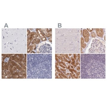 Anti-ALDH8A1 antibody produced in rabbit Prestige Antibodies&#174; Powered by Atlas Antibodies, affinity isolated antibody, buffered aqueous glycerol solution