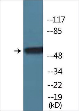 Anti-phospho-TR-&#946;1 (pSer142) antibody produced in rabbit affinity isolated antibody