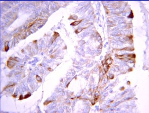 Anti-DAPK2 Antibody from rabbit, purified by affinity chromatography