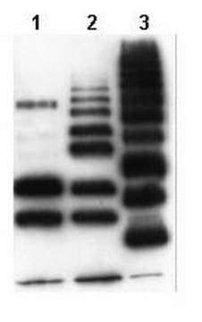 Anticorps anti-protéines ubiquitinylées, clone&nbsp;FK2 clone FK2, Upstate&#174;, from mouse