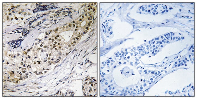 Anti-LAMA3 antibody produced in rabbit affinity isolated antibody