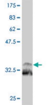 Monoclonal Anti-TITF1 antibody produced in mouse clone 2F6, purified immunoglobulin, buffered aqueous solution