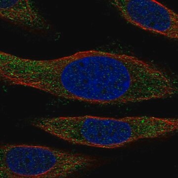 Anti-Nccrp1 Antibody Produced In Rabbit Prestige Antibodies&#174; Powered by Atlas Antibodies, affinity isolated antibody, buffered aqueous glycerol solution