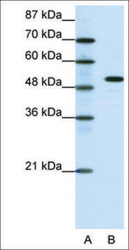 Anti-SPIB antibody produced in rabbit affinity isolated antibody