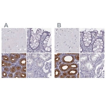 Anti-C6orf58 antibody produced in rabbit Prestige Antibodies&#174; Powered by Atlas Antibodies, affinity isolated antibody, buffered aqueous glycerol solution