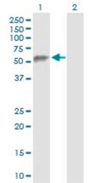 Anti-ESAM antibody produced in rabbit purified immunoglobulin, buffered aqueous solution