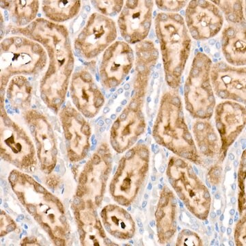 Anti-PDK1/PDHK1 Antibody, clone 5T6S8, Rabbit Monoclonal