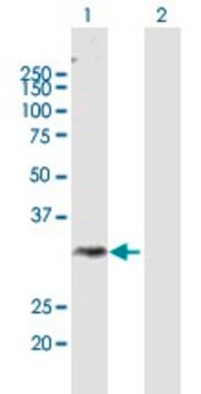 Anti-DGAT2L3 antibody produced in mouse purified immunoglobulin, buffered aqueous solution